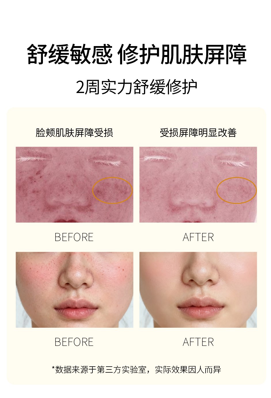 洋甘菊舒缓喷雾详情_08.jpg