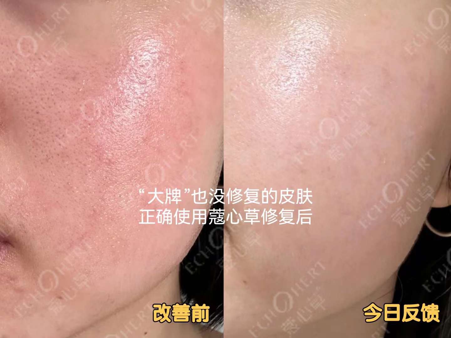 敏感 (2).jpg